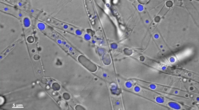 'Fungal pipeline' - Hyphae promote contaminant bioavailability by uptake, cytoplasmic streaming and release of phenanthrene (in blue)
(© Susan Foß/UFZ)